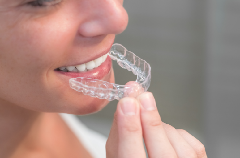 pani zakładająca nakładkę dentystyczna